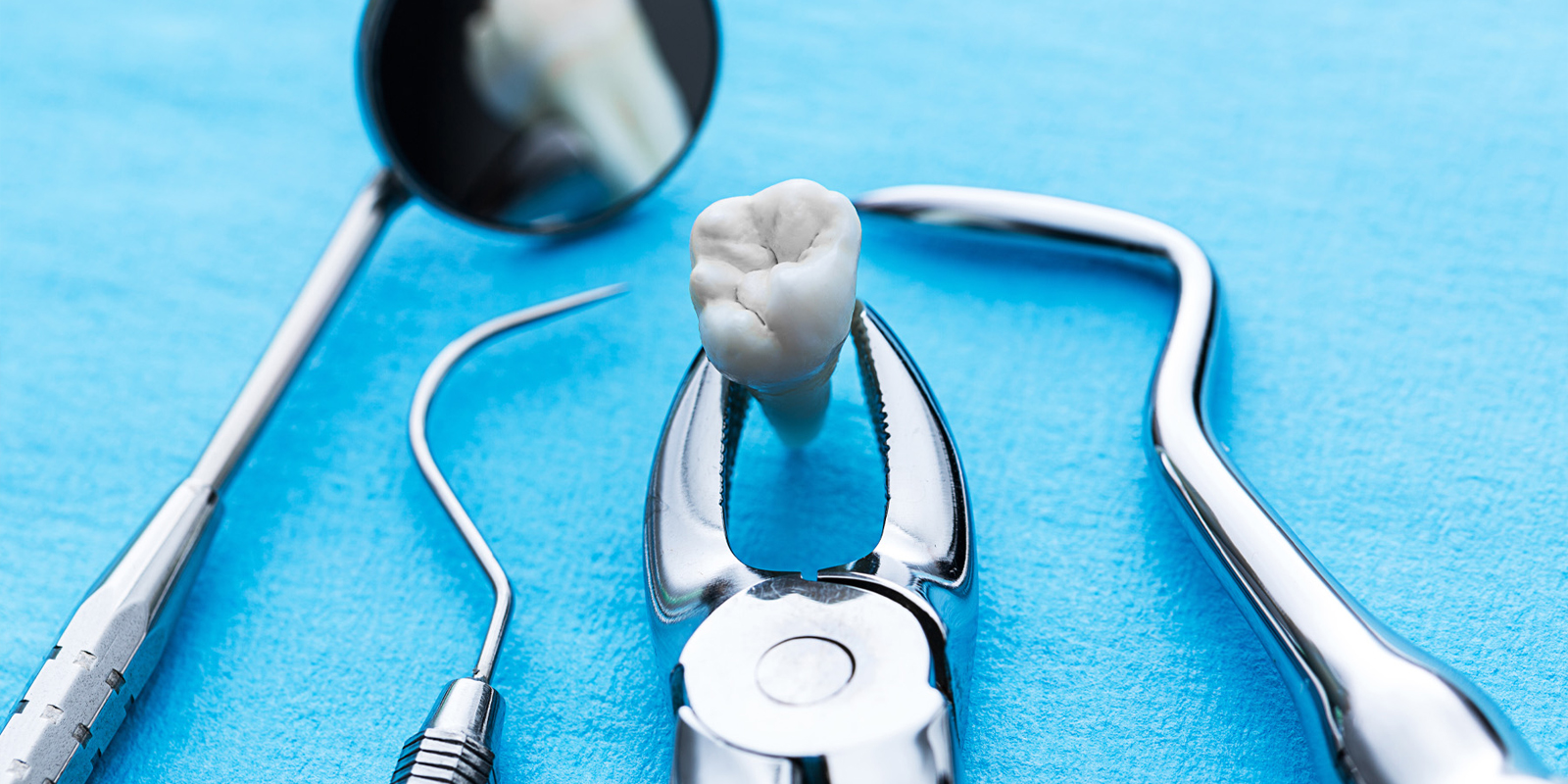 親知らずは抜くべき?抜かなくていい?