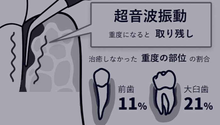 術前