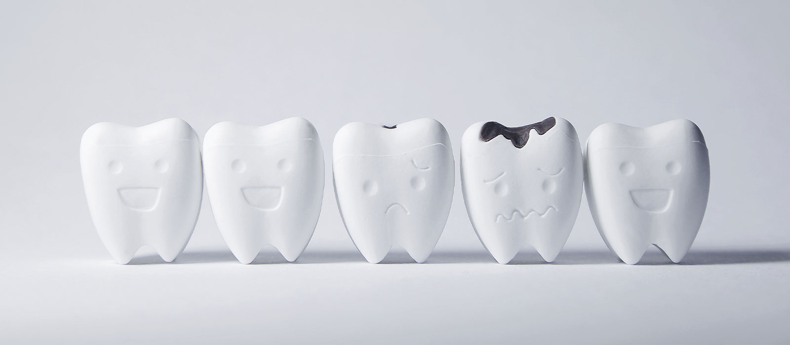 虫歯の症状段階・治療法について